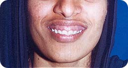 Before-Cosmetic Surgeries