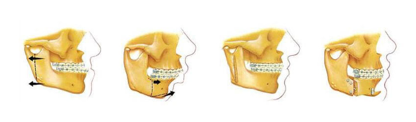 850x250-Oral-and-Maxillofacial-Surgery