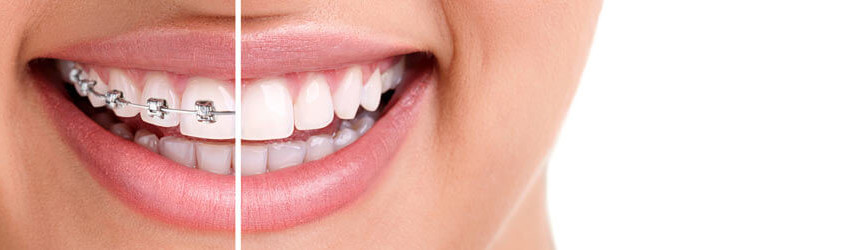 850x250-Orthodontics