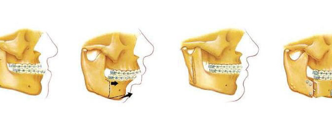 850x250-Oral-and-Maxillofacial-Surgery