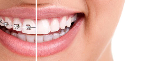 850x250-Orthodontics